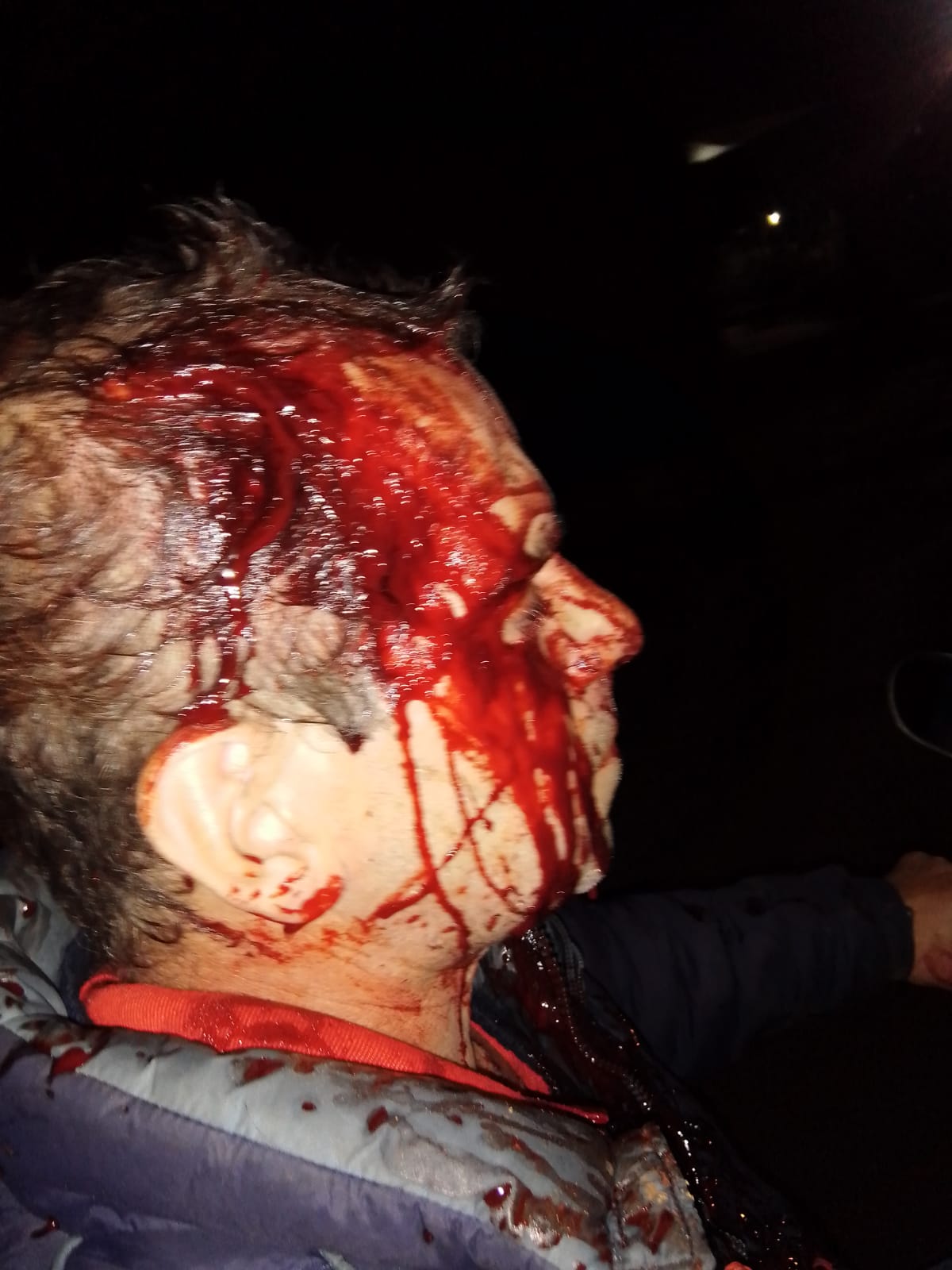 Lo abordaron, se resistió al robo y terminó con 4 puntos en la cabeza