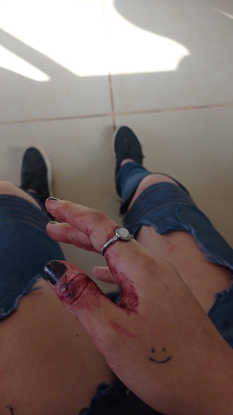 Luchador de Jui-Jitsu golpeo e intentó afixiar a su pareja