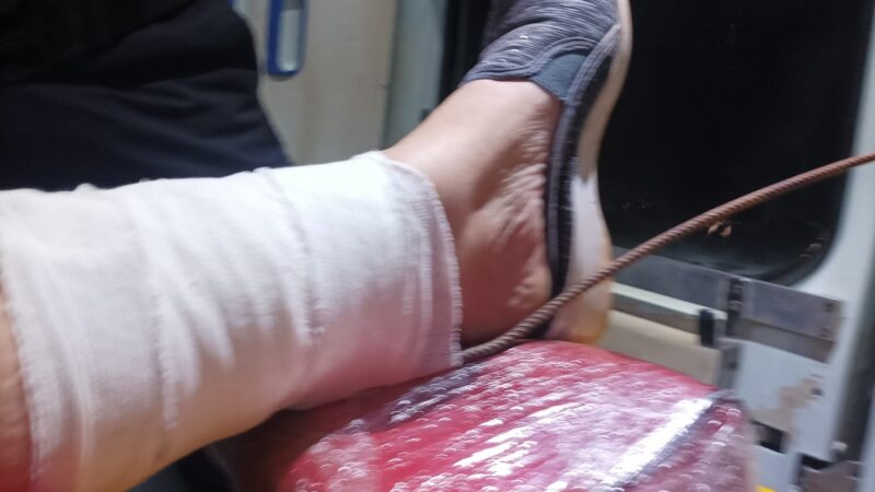 Bomberos auxiliaron a una turista que cayó y se incrusto un hierro en la pantorrilla