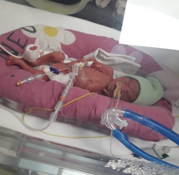 Julián nació con 700gr, peleo por vivir, pero no puede ir a casa porque no cuenta con las condiciones sanitarias necesarias