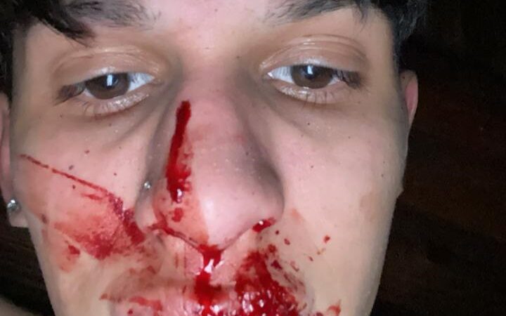 Recibió una golpiza a la salida de un cumpleaños y denunció a un profesor de taekwondo por el hecho