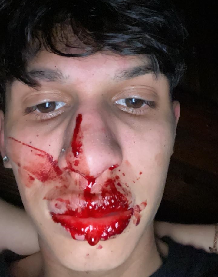 Recibió una golpiza a la salida de un cumpleaños y denunció a un profesor de taekwondo por el hecho