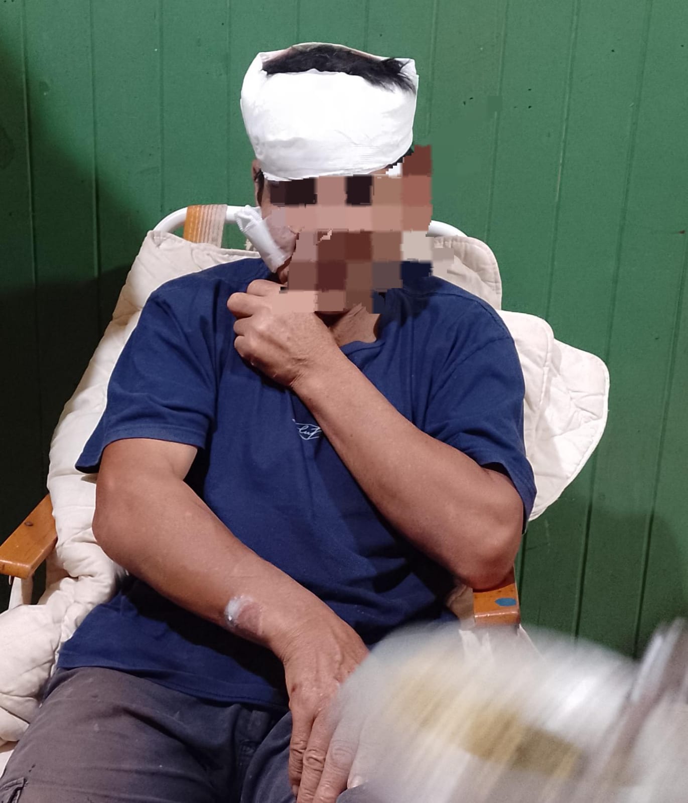 Iguazú: Iba a trabajar, lo atropellaron y se dieron a la fuga dejándolo tirado en el asfalto