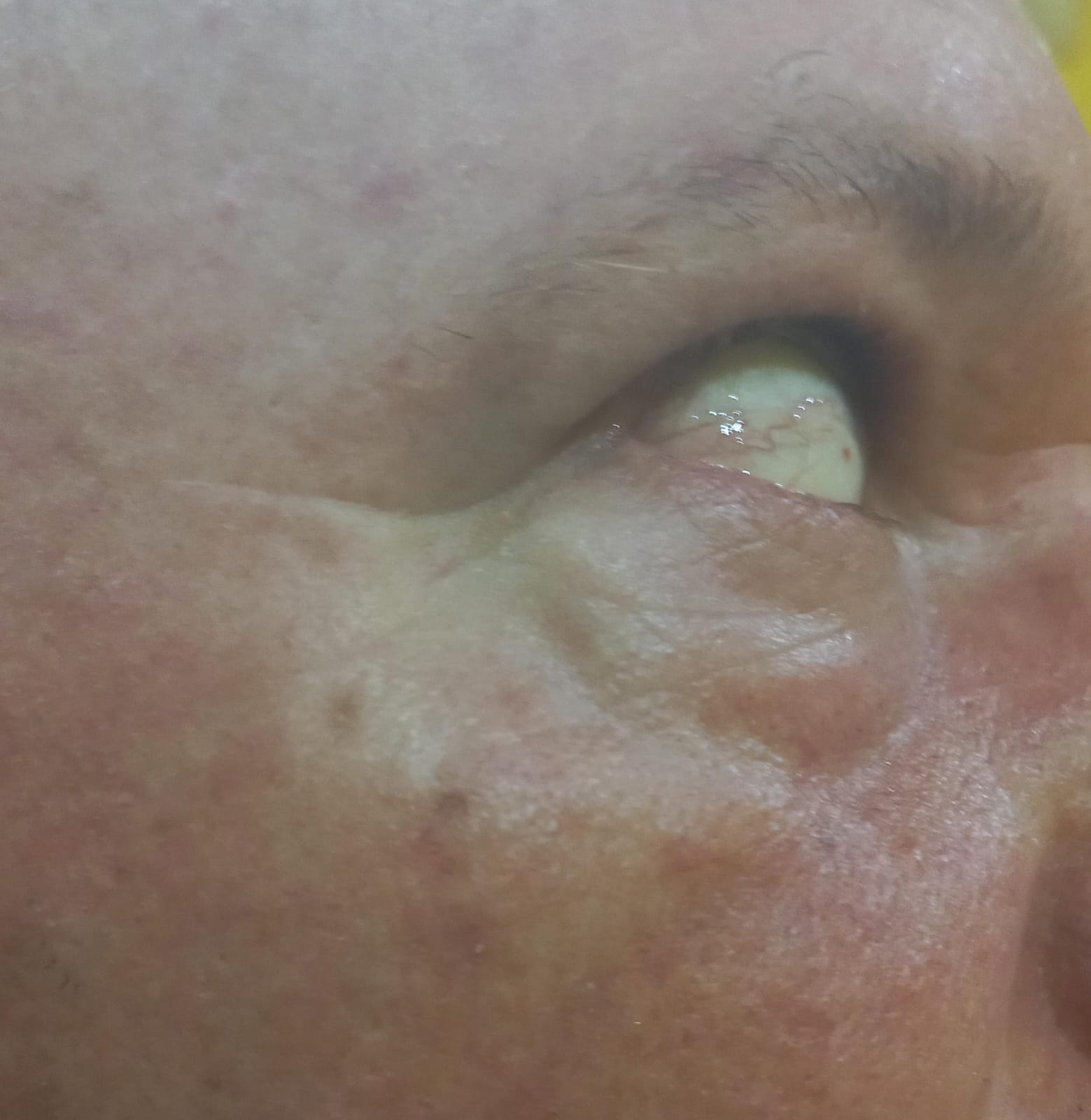 Tomaba mate en la vereda con su madre y fue impactado por proyectiles de hidrogel en la cara, uno en el ojo