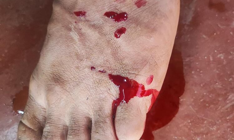 Joven debió ser atendido en la guardia del hospital tras ser mordido por un perro en la calle