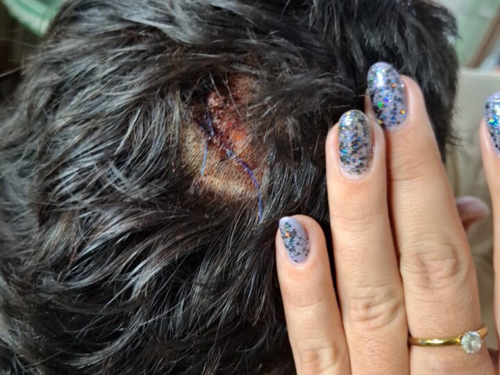 Denunció que fue atacado con un machete tras los festejos de la semifinal