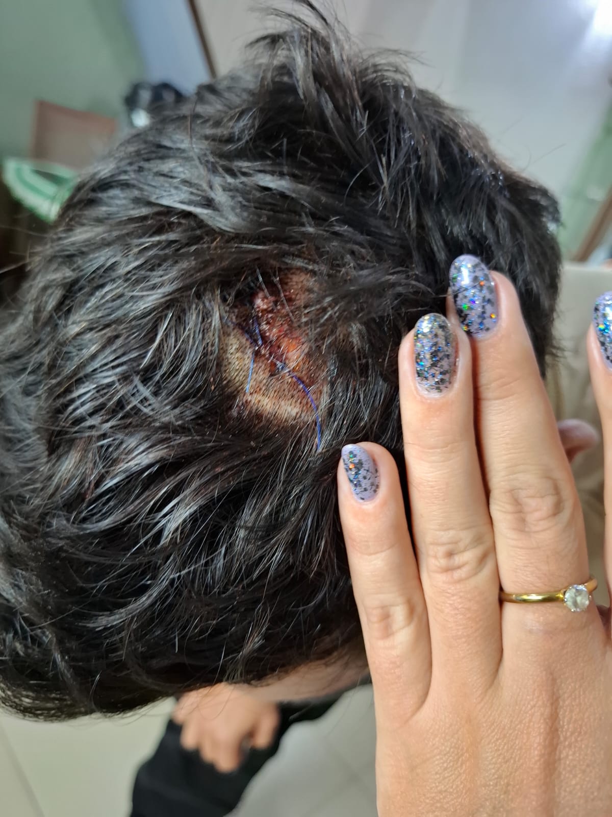 Denunció que fue atacado con un machete tras los festejos de la semifinal